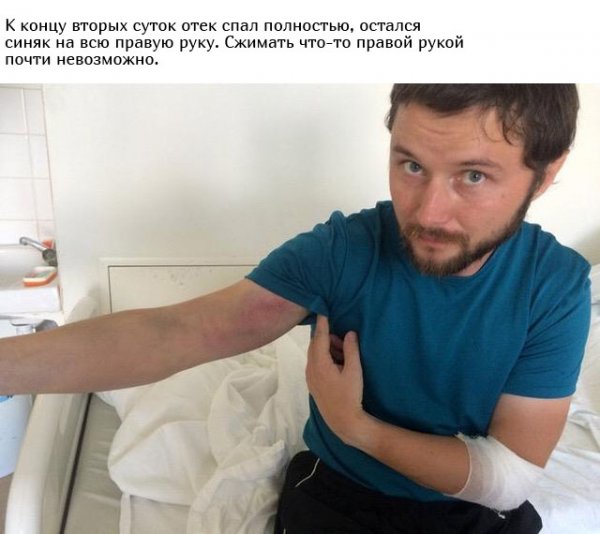 Укус гадюки из первых уст